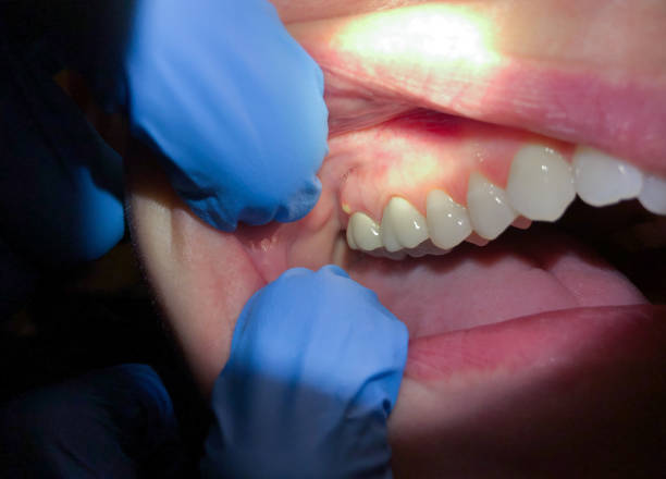 Best Emergency Dental Care for Trauma or Injury in Parkville, MO